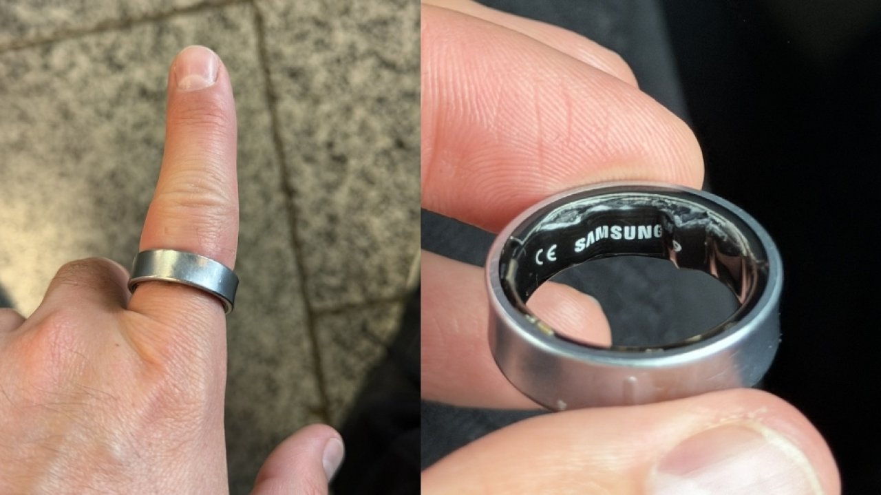 Smart pierścień posłał go do szpitala. Czy ten gadżet jest poważnym zagrożeniem?