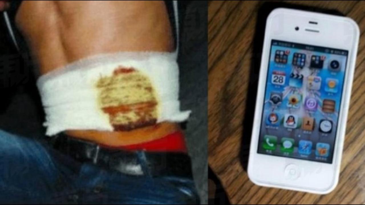 Sprzedał nerkę za iPhone`a. Resztę życia spędzi przykuty do łóżka