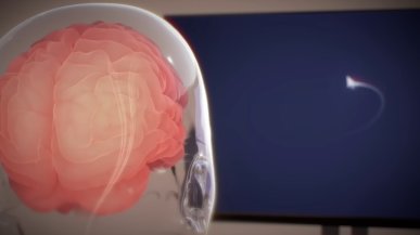 Elon Musk i Neuralink wszczepią chip mózgowy drugiemu pacjentowi. Jest zgoda FDA