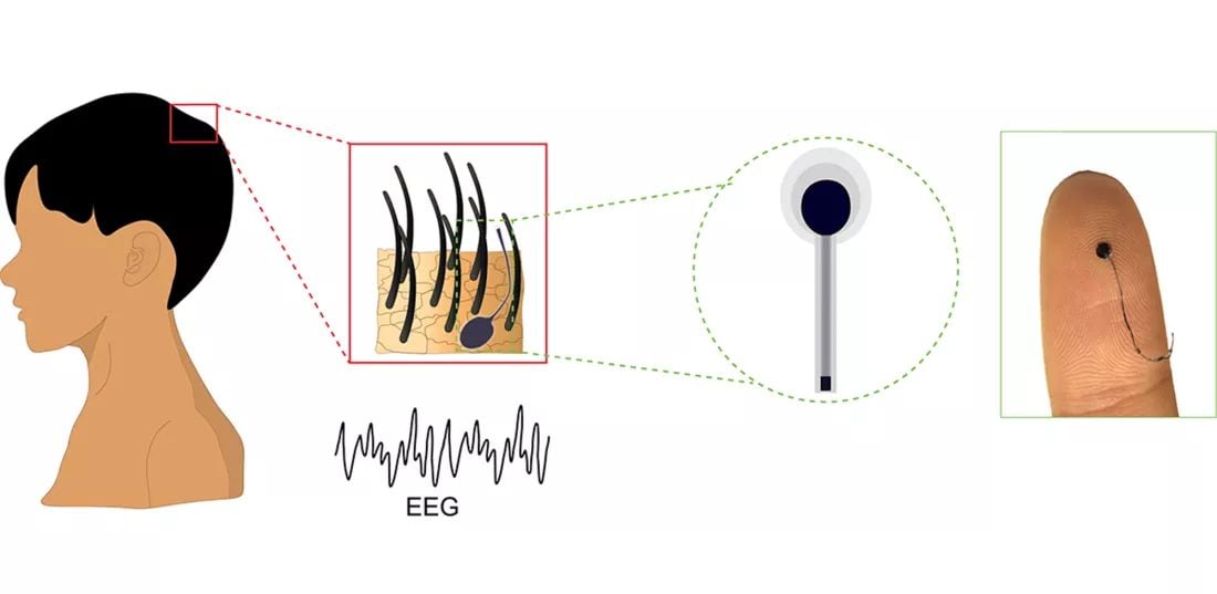 EEG